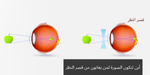 20240115 232111 0000 المدونة