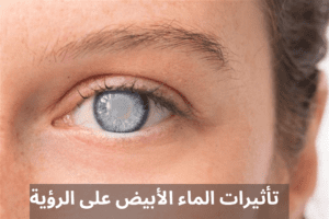 Add a heading 20240427 095820 0000 المدونة