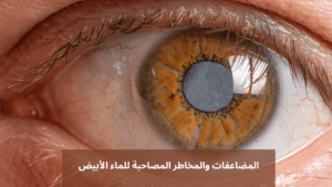 والمخاطر المصاحبة للماء الأبيض 20240430 202100 0000 المدونة