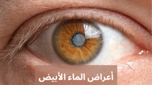 الماء الأبيض 20240520 145400 0000 المدونة