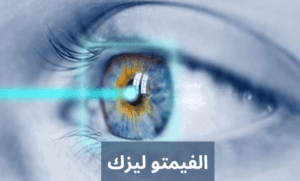 ليزك 20240502 015611 0000 المدونة