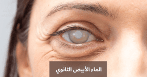 البيضاء هل تسبب العمى 20240517 154137 0000 المدونة