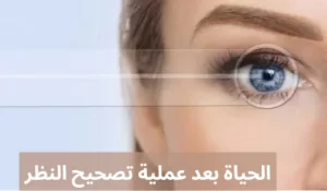 بعد عملية تصحيح النظر 20240723 195731 0000 المدونة