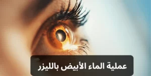 الماء الأبيض بالليزر 20240809 171504 0000 المدونة