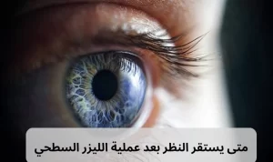 يستقر النظر بعد عملية الليزر السطحي 20240805 154559 0000 المدونة