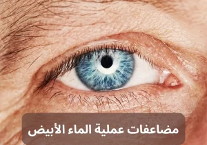 عملية الماء الابيض 20240806 171745 0000 المدونة