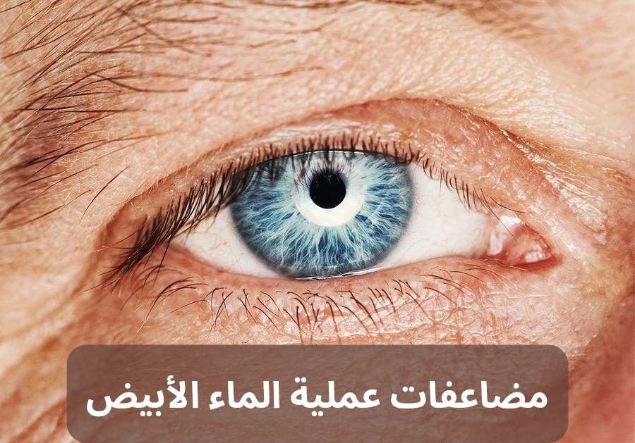 عملية الماء الابيض 20240806 171745 0000 مضاعفات عملية الماء الأبيض