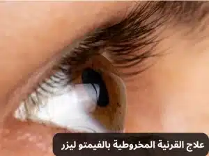 القرنية المخروطية بالفيمتو ليزر 20240921 005629 0000 المدونة