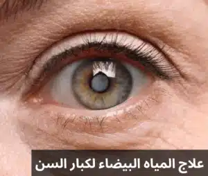 المياه البيضاء لكبار السن 20241027 225336 0000 المدونة