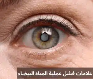 فشل عملية المياه البيضاء 20241031 014247 0000 المدونة