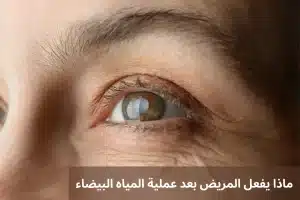 يفعل المريض بعد عملية المياه البيضاء 20241025 234202 0000 المدونة