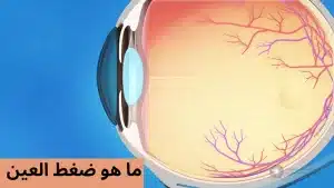 المدونة 2 هو ضغط العين 20250213 213333 0000 المدونة