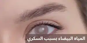 1000271168 المدونة