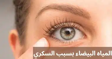 1000271169 المياه البيضاء بسبب السكري