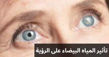 تأثير المياه البيضاء على الرؤية 2 1000271700 تأثير المياه البيضاء على الرؤية