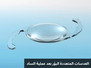 1000271825 المدونة