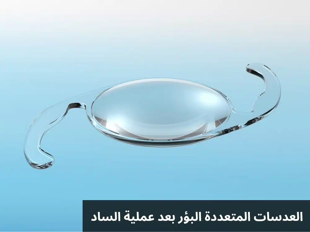 العدسات المتعددة البؤر بعد عملية الساد 1 العدسات المتعددة البؤر بعد عملية الساد