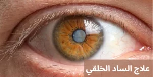 1000272374 المدونة