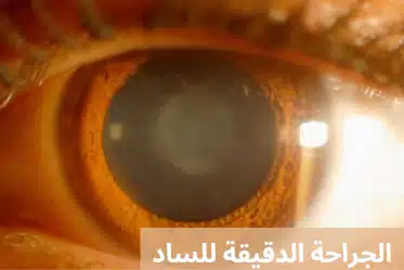 1000272644 الجراحة الدقيقة للساد
