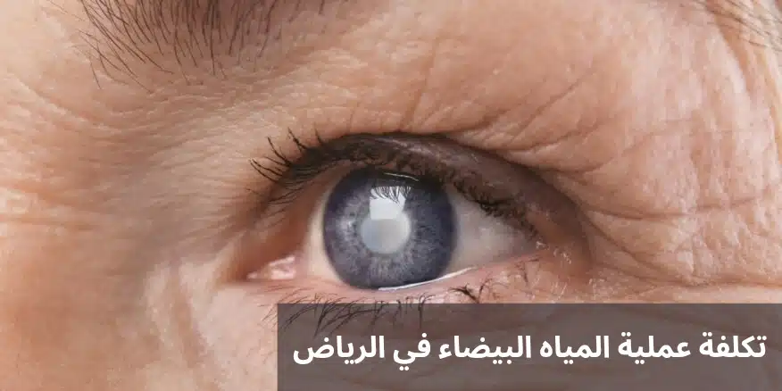 تكلفة عملية المياه البيضاء في الرياض 3 1000273920 تكلفة عملية المياه البيضاء في الرياض