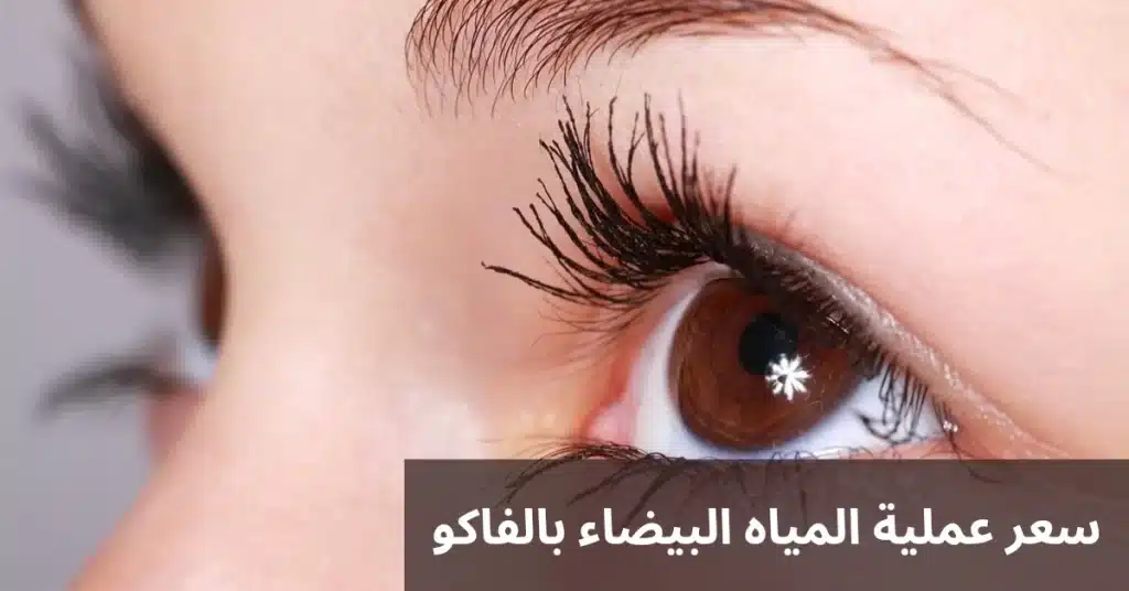 سعر عملية المياه البيضاء بالفاكو 1 1000274851 سعر عملية المياه البيضاء بالفاكو