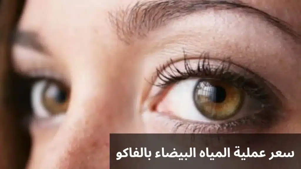 سعر عملية المياه البيضاء بالفاكو 2 سعر عملية المياه البيضاء بالفاكو
