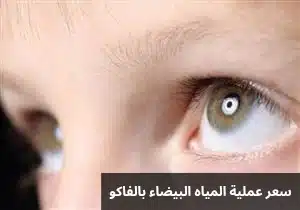 سعر عملية المياه البيضاء بالفاكو 3 1000274853 سعر عملية المياه البيضاء بالفاكو