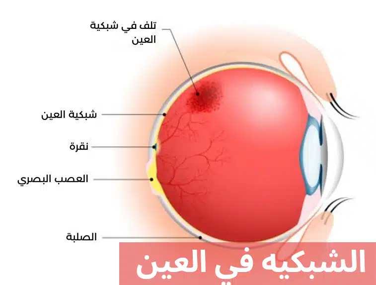 الشبكيه في العين 2 1000275741 الشبكيه في العين
