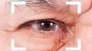 المدونة 2 cataract treatment 2 1 2 المدونة