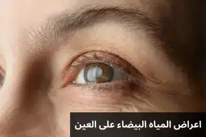 1000281519 المدونة