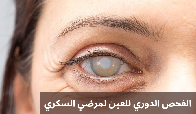 اضرار عملية المياه البيضاء 1 اضرار عملية المياه البيضاء