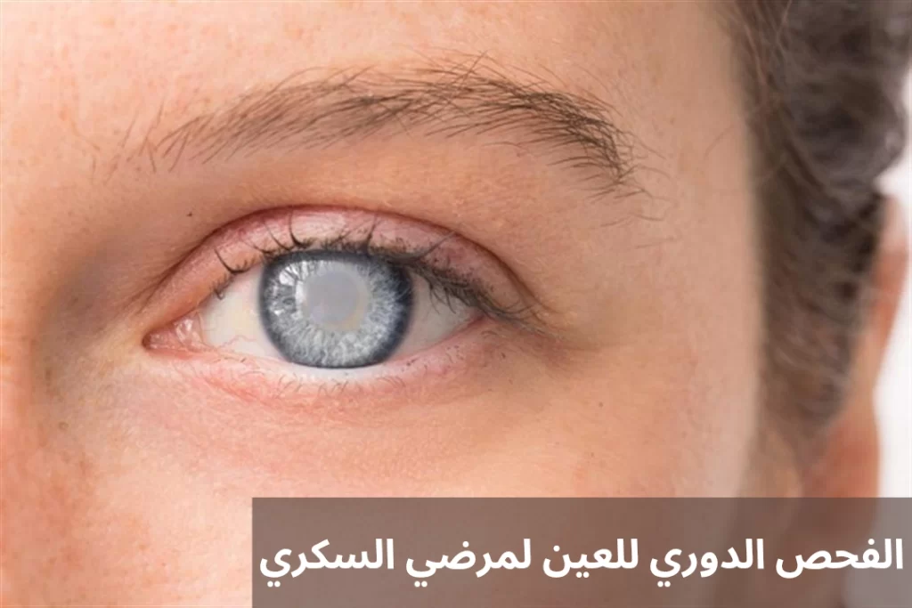 اضرار عملية المياه البيضاء 2 1000283674 اضرار عملية المياه البيضاء