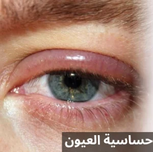 1000284546 المدونة