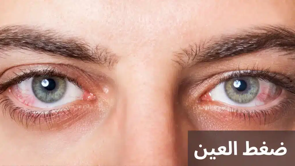 ضغط العين 2 1000286923 ضغط العين