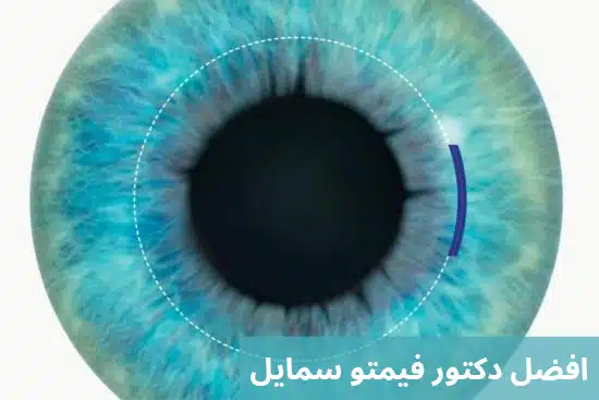 افضل دكتور فيمتو سمايل 2 1000287053 افضل دكتور فيمتو سمايل