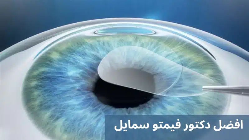 افضل دكتور فيمتو سمايل 1 افضل دكتور فيمتو سمايل