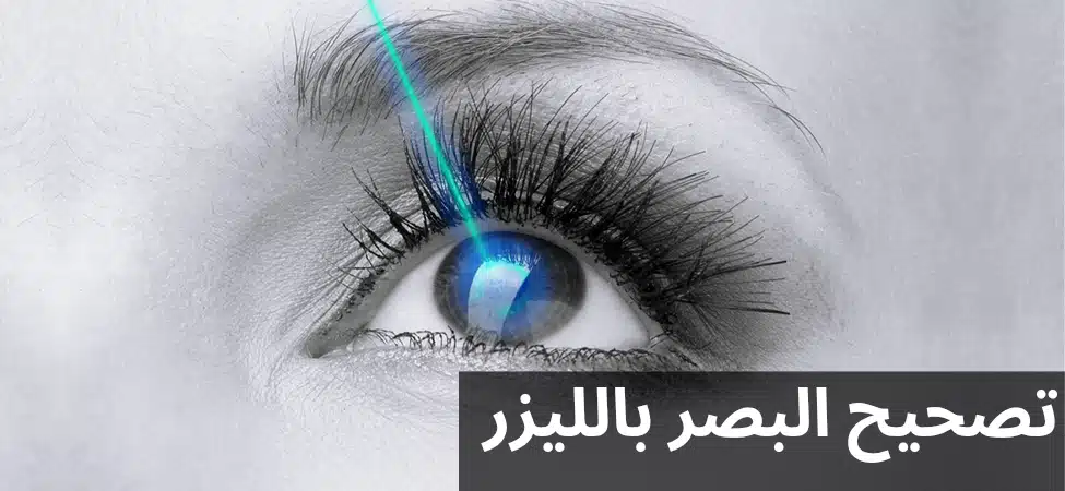 تصحيح البصر بالليزر 2 1000287907 تصحيح البصر بالليزر