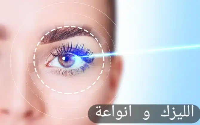 الليزك و انواعة 1 1000288820 الليزك و انواعة