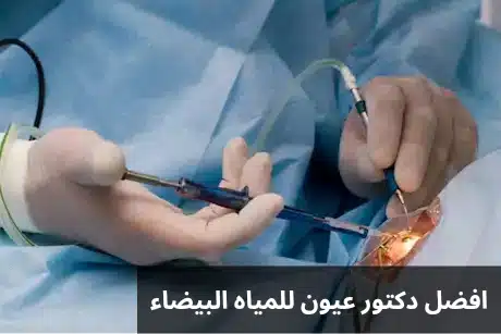 1000289501 افضل دكتور عيون للمياه البيضاء