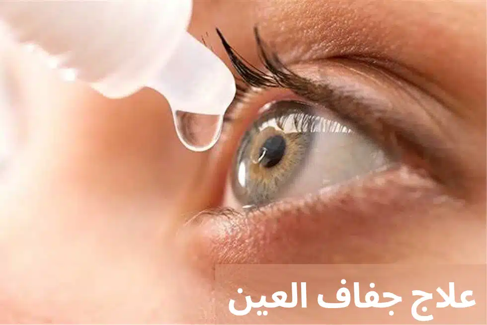 1000292587 علاج جفاف العين
