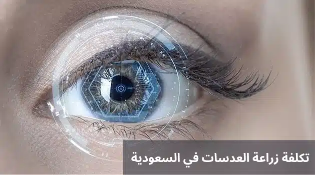 تكلفة زراعة العدسات في السعودية
