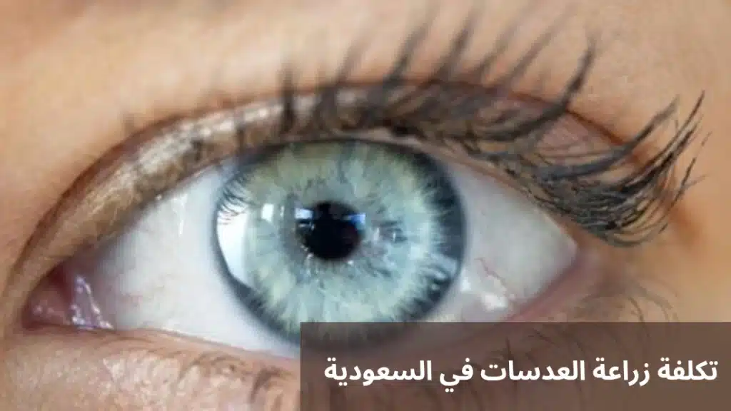 تكلفة زراعة العدسات في السعودية