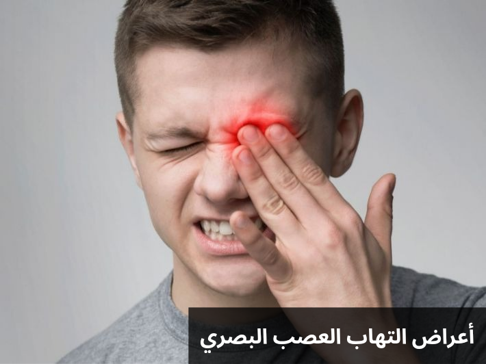 أعراض التهاب العصب البصري
