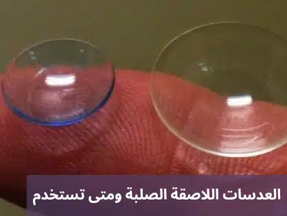 1000298074 1 العدسات اللاصقة الصلبة ومتى تستخدم