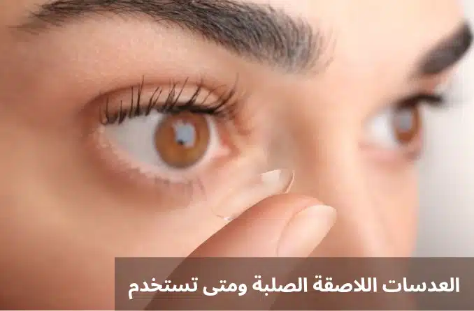 1000298076 العدسات اللاصقة الصلبة ومتى تستخدم