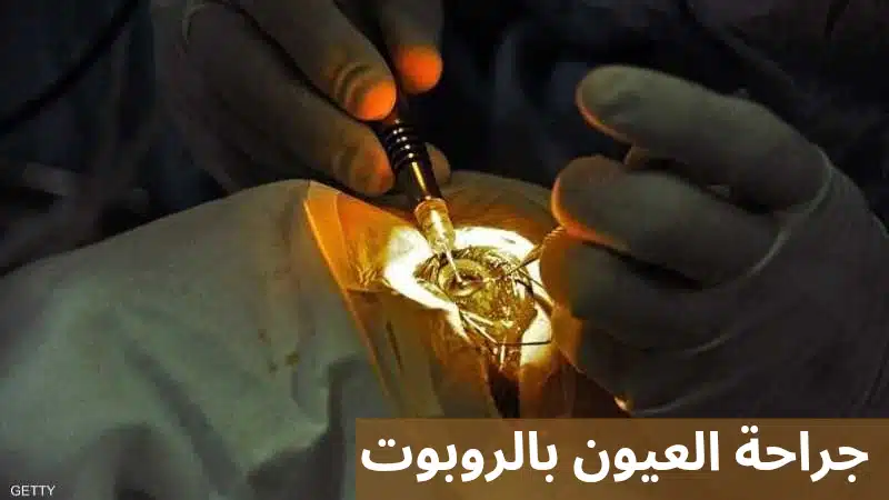 جراحة العيون بالروبوت
