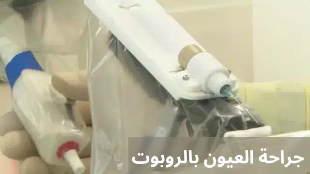 1000298298 جراحة العيون بالروبوت