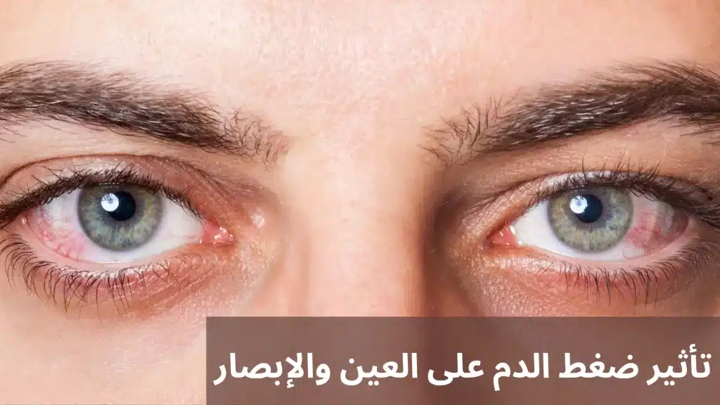 تأثير ضغط الدم على العين والإبصار