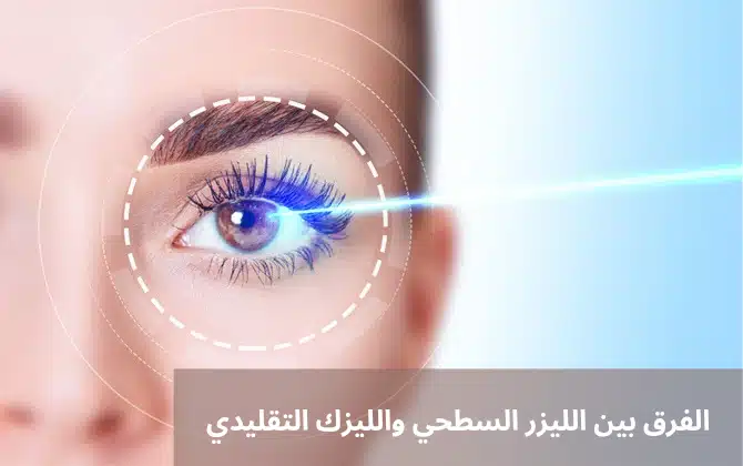 1000298601 الفرق بين الليزر السطحي والليزك التقليدي