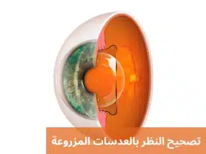 1000299316 المدونة